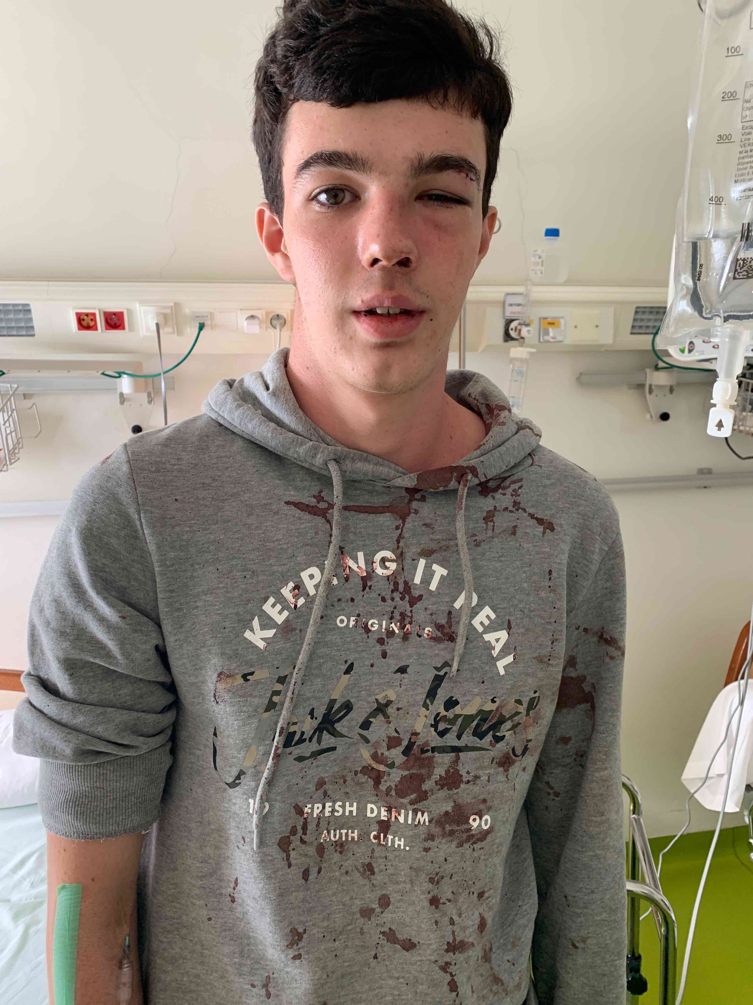 Axel Brunel, 17 ans, hospitalisé après une agression d’une rare violence à Corti
